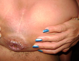 MILF self anal fisting gall Image 8