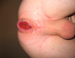 Gay horny fisting gallery Image 5