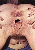 bbb4.jpg