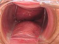 speculum10.jpg